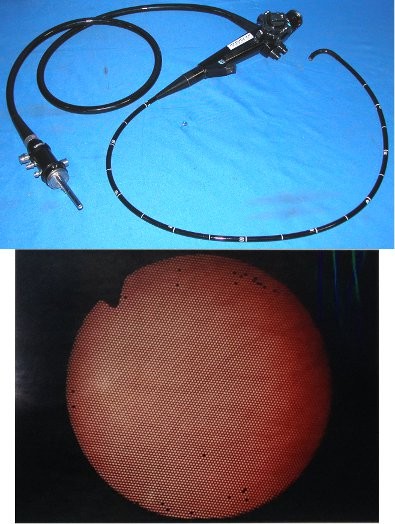 picture of olympus pediatric gastroscope