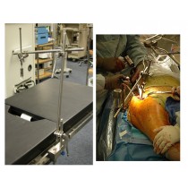 picture of omni trac table mounted 