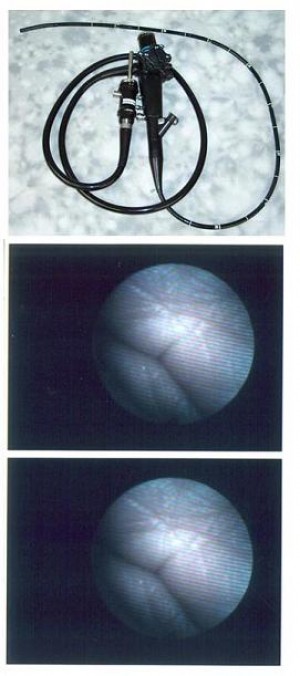 picture of olympus gif-xp20 pediatric gastroscope