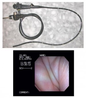picture of olympus jf-100 video duodenoscope